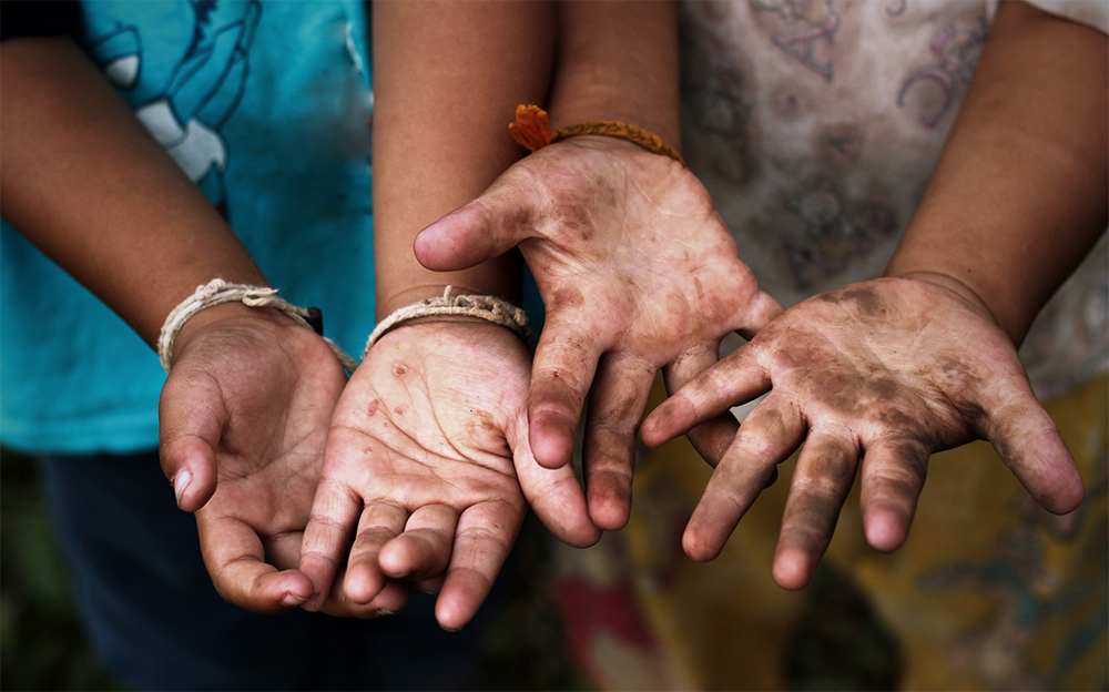 04 ZdravjeRanliviGrupi